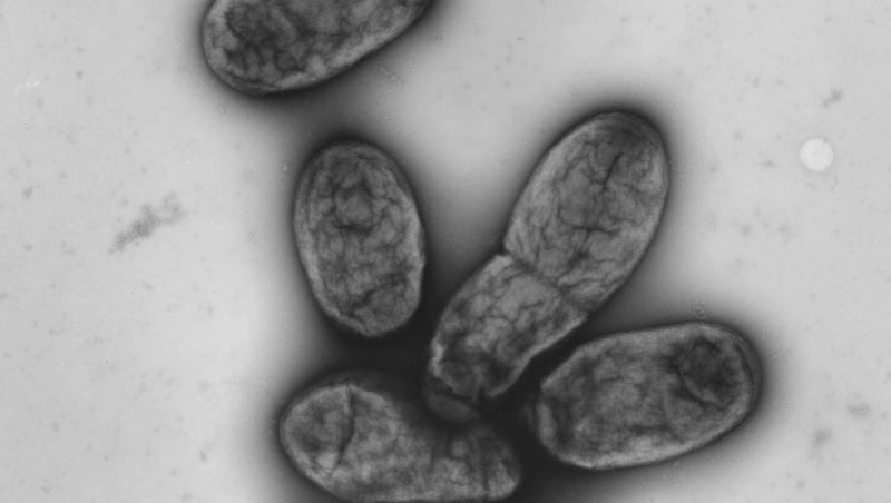 Eine elektronenmikroskopische Aufnahme zeigt das Pestbakterium Yersinia pestis. In China wurde der vierte Fall einer Pestinfektion innerhalb weniger Wochen gemeldet. Eine elektronenmikroskopische Aufnahme zeigt das Pestbakterium Yersinia pestis. In China wurde der vierte Fall einer Pestinfektion innerhalb weniger Wochen gemeldet.