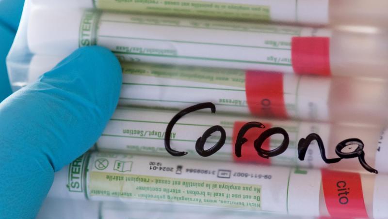 Proben für Corona-Tests werden in einem Labor vorbereitet. Proben für Corona-Tests werden in einem Labor vorbereitet.