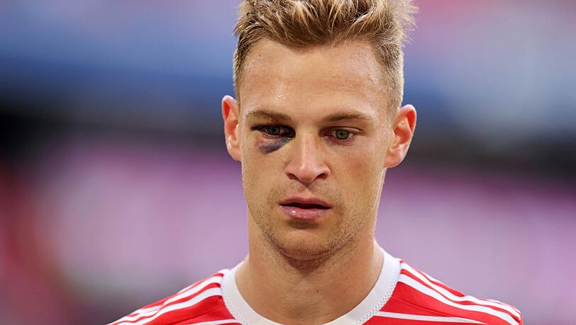 "Mittlerweile habe ich bei ihm das Gefühl, dass er glänzen will und dass man ihn aufgrund seines Status nicht mehr angreifen, geschweige denn berühren darf", sagt Markus Babbel über Joshua Kimmich. "Mittlerweile habe ich bei ihm das Gefühl, dass er glänzen will und dass man ihn aufgrund seines Status nicht mehr angreifen, geschweige denn berühren darf", sagt Markus Babbel über Joshua Kimmich.