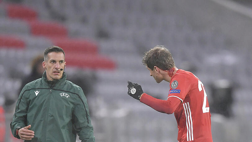 Thomas Müller bemerkte seine blutende Wunde nicht. Thomas Müller bemerkte seine blutende Wunde nicht.