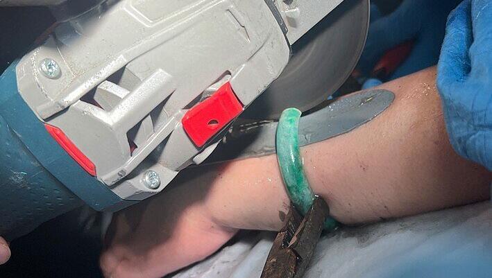 Die Münchner Feuerwehr musste einer Frau den geliebten Jadeschmuck vom Arm sägen. Die Münchner Feuerwehr musste einer Frau den geliebten Jadeschmuck vom Arm sägen.